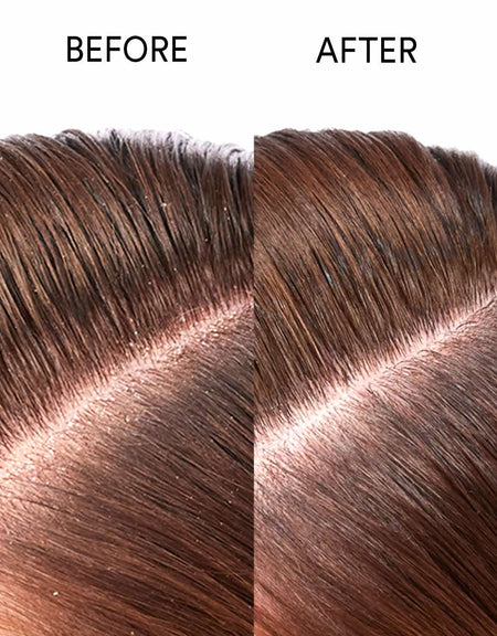 Pure Genius Scalp Oil - Hair by Sam McKnight